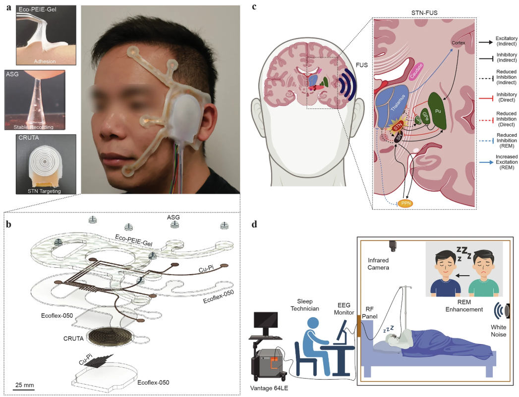 Skin-attached bioadhesive patch enabling ultrasound deep brain stimulation and real-time electrophysiological monitoring for REM sleep enhancement